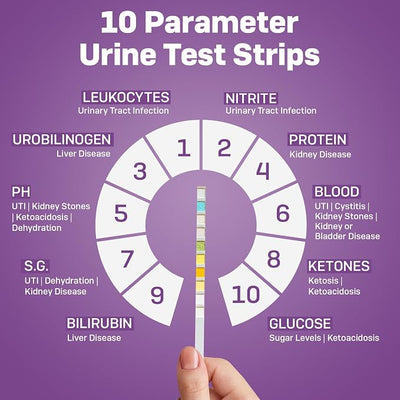 One Step Pet Urine Testing Strips, 5 x 10 Parameter Urinalysis Test Strips, Urine pH Test Strips for Dogs, Cats, Accurate Testing for UTI, Bladder & More, Pet Glucose Monitoring Kit