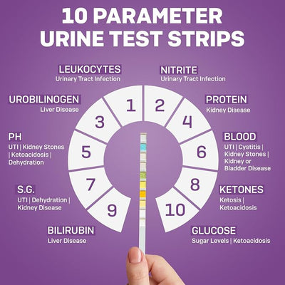 One Step Pet Urine Testing Strips, 50 x Urinalysis Parameter Tests for Dogs, Cats, Vets, Accurate Testing for Veterinarians, Detects UTI, Diabetes, Bladder, Kidney, Liver, SG, pH, Glucose